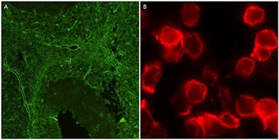 AQP4 Antibody Assay Sensitivity Comparison in the Era of the 2015 Diagnostic Criteria for NMOSD